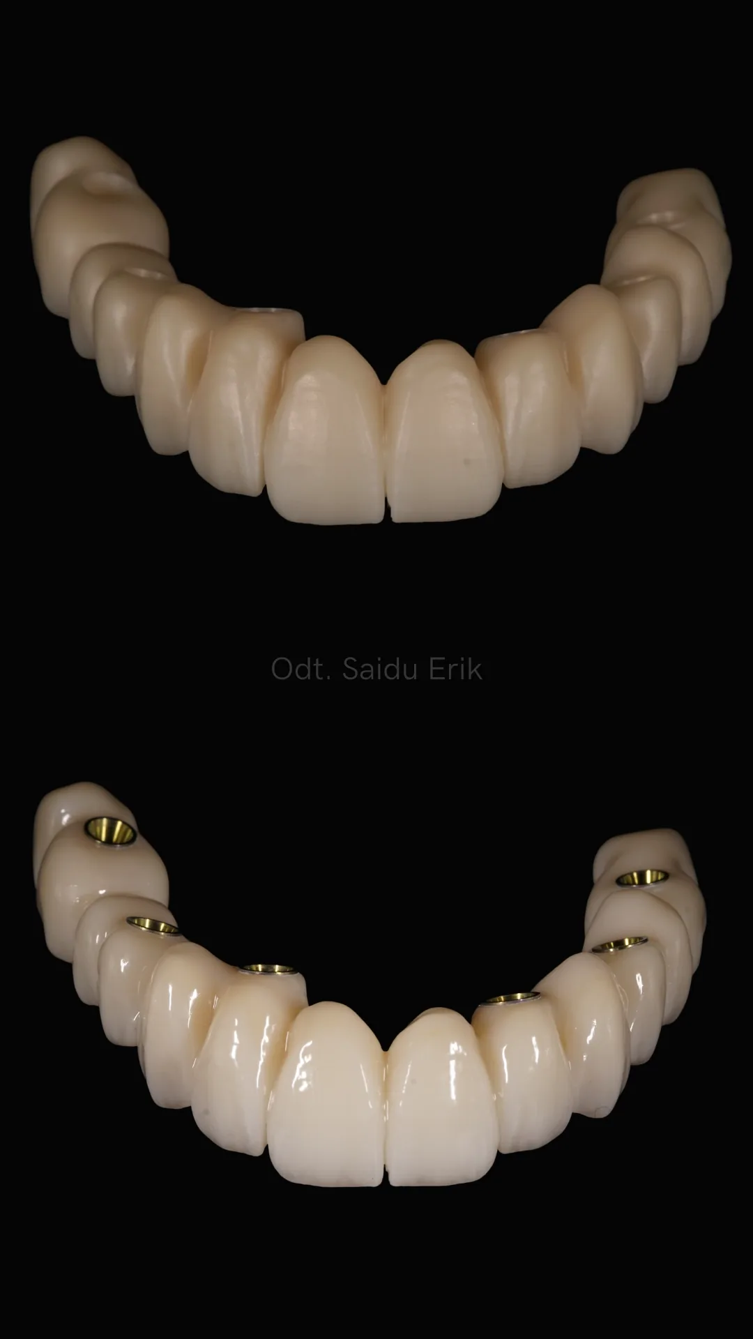 All on X in zirconia micro stratificata, caso 1: arcata superiore e inferiore su fondo nero