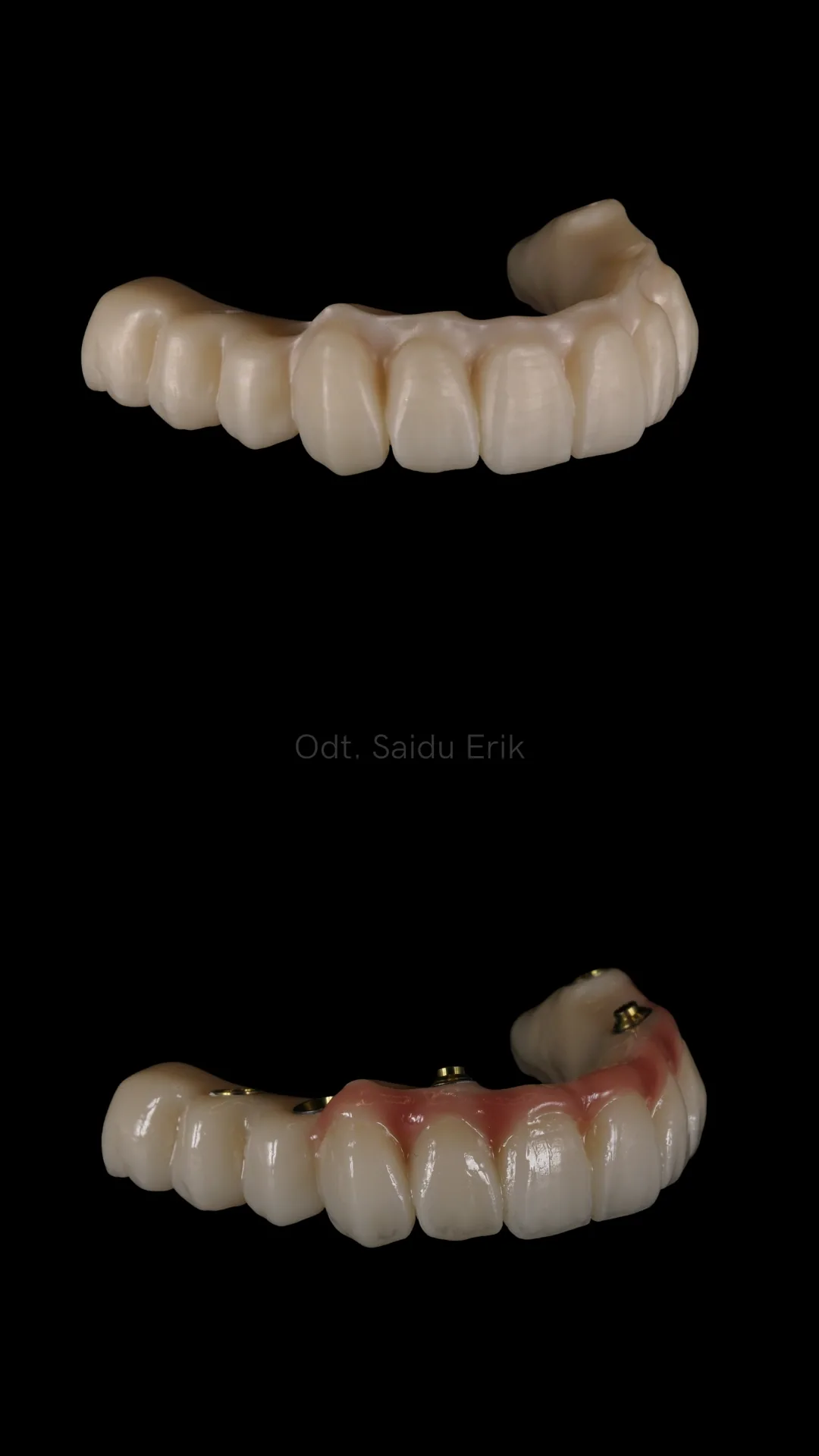 All on X in zirconia micro stratificata, caso 2: arcata superiore e inferiore su fondo nero