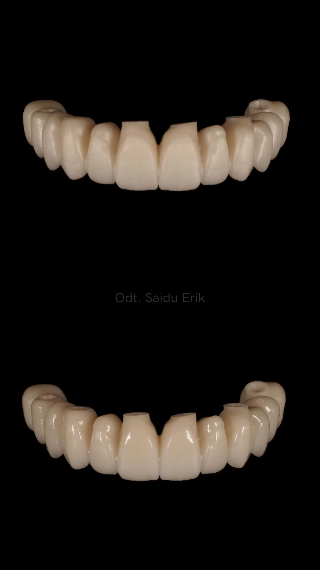 All on X in zirconia micro stratificata, caso 3: arcata superiore e inferiore su fondo nero