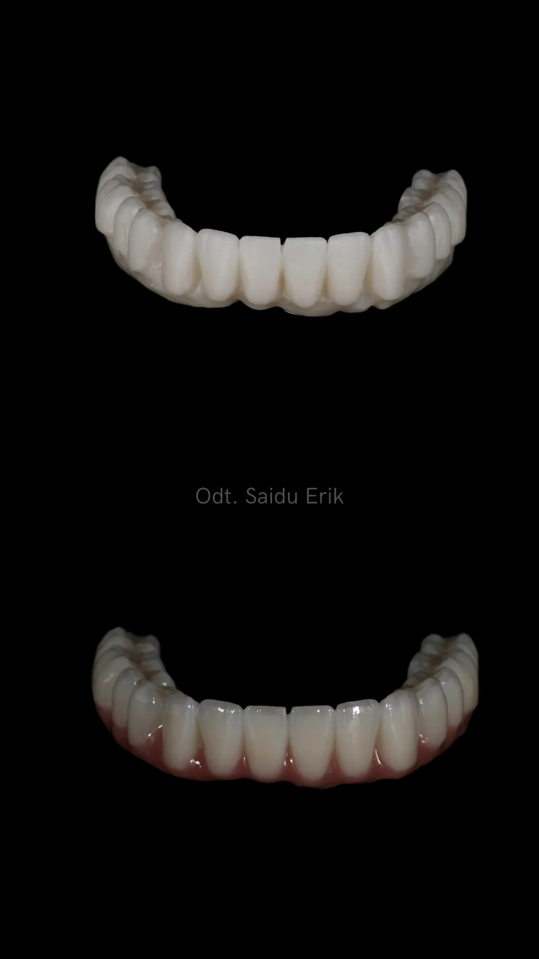All on X in zirconia micro stratificata, caso 4: arcata superiore e inferiore su fondo nero