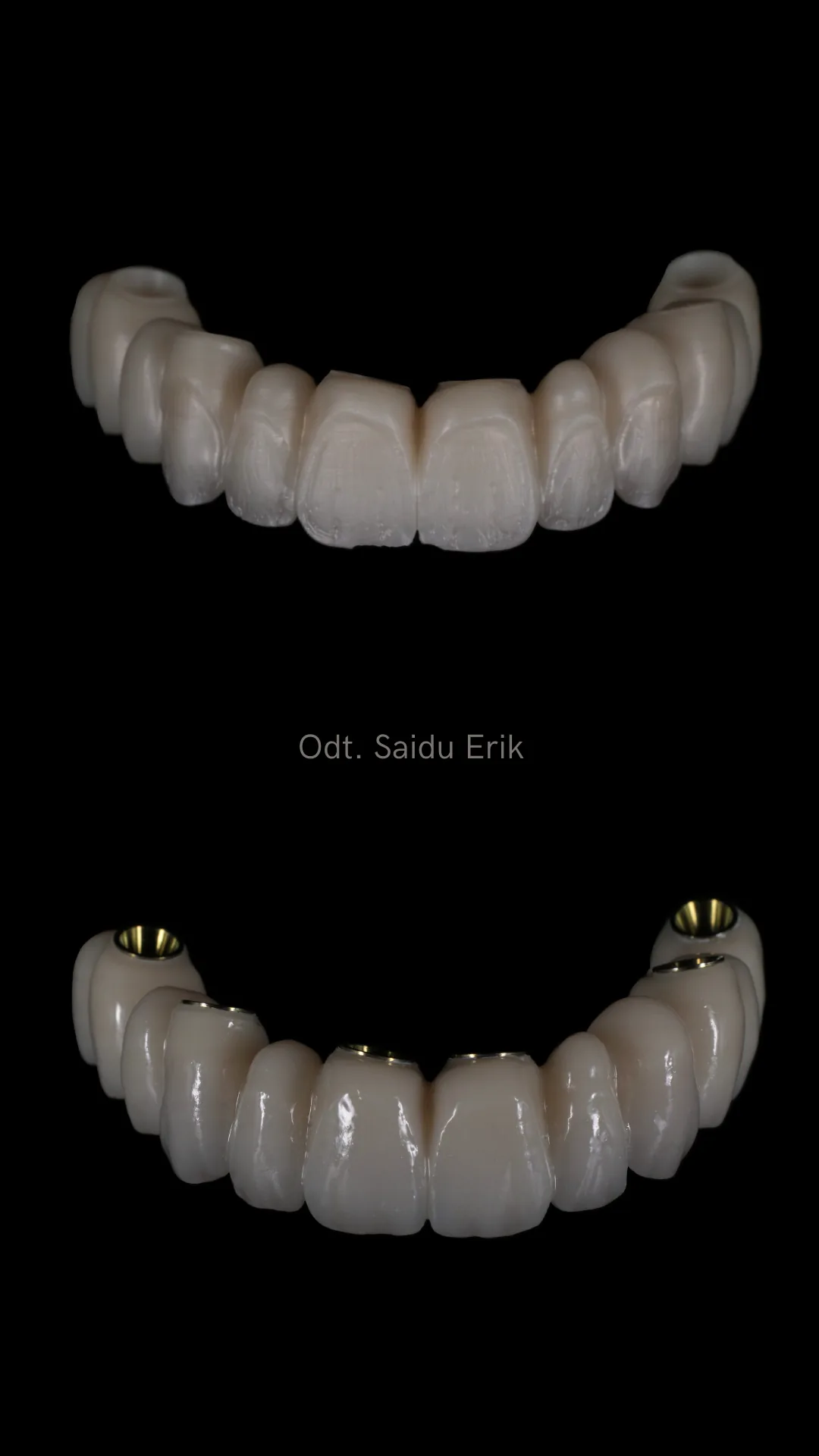 All on X in zirconia stratificata tradizionalmente, caso 7: arcata superiore e inferiore su fondo nero