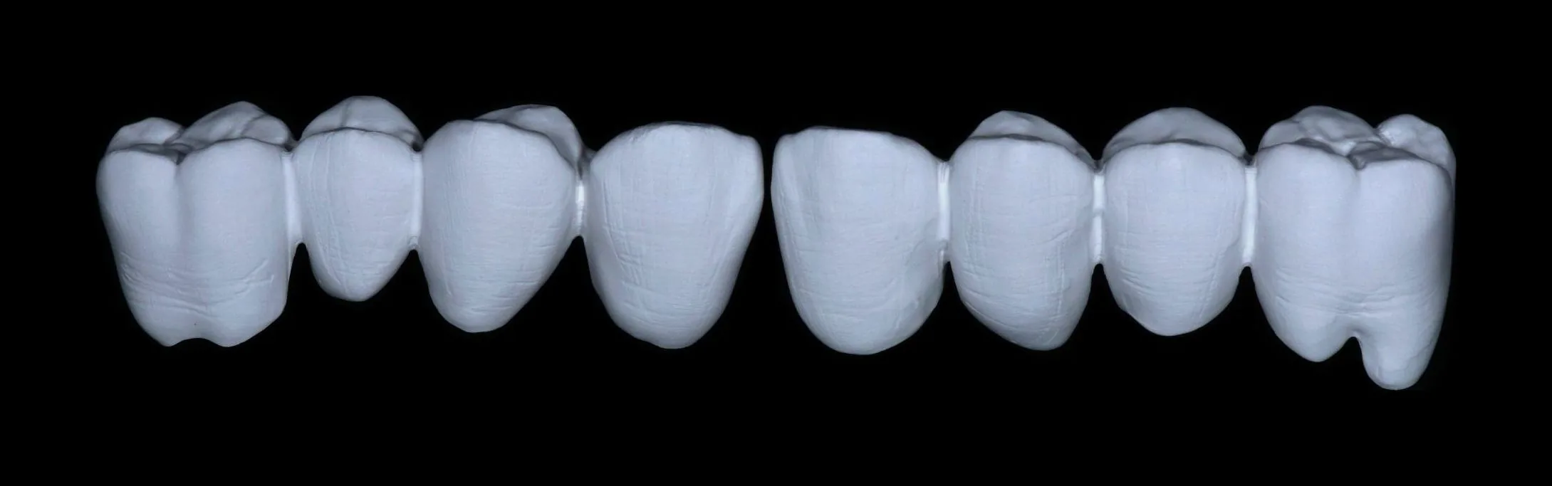 Gli elementi dell'arcata in zirconia bianca, vista frontale