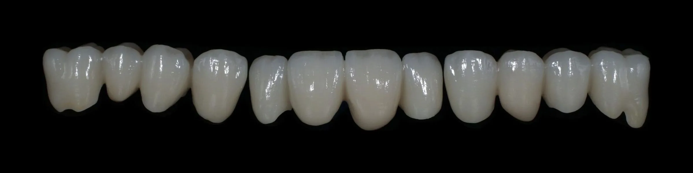 Arcata superiore in zirconio ceramica, vista frontale del lavoro finito